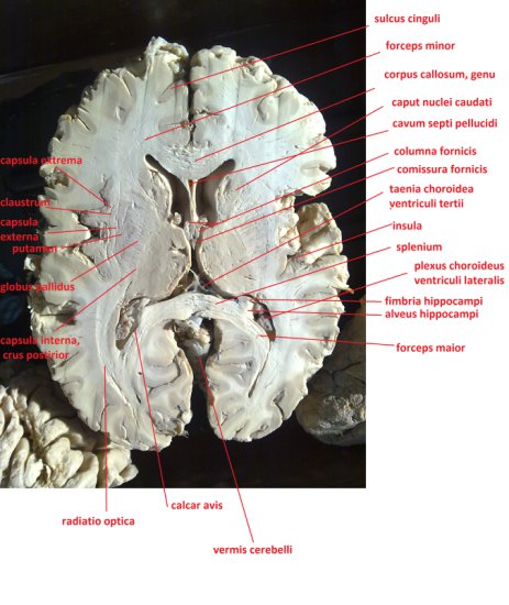 foty opisane mózg - salami.jpg